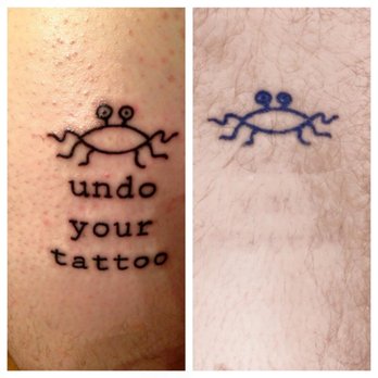 Disappearing inc - Tattoo Removal Near Me - Northampton, Massachusetts