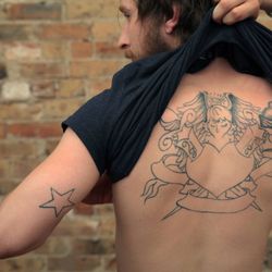 Removery Tattoo Removal & Fading