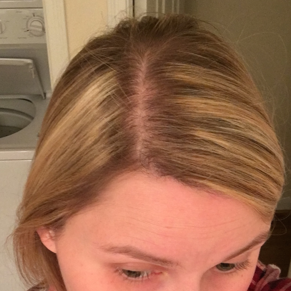 Upper Hand Salon - Looks worse in real life, but dark at back, still a little brassy, bleach started way too far from root. This is after a week. - Hair Salons Near Me - Houston, Texas Upper Hand Salon - Looks worse in real life, but dark at back, still a little brassy, bleach started way too far from root. This is after a week. - Hair Salons Near Me - Houston, Texas