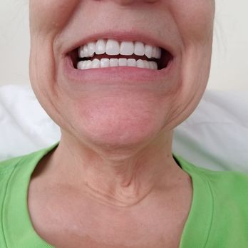Excel Dental & Dentures - I love them! They are very comfortable. - Prosthodontists Near Me - Lynnwood, Washington Excel Dental & Dentures - I love them! They are very comfortable. - Prosthodontists Near Me - Lynnwood, Washington