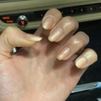 Neo Nails Brickell - Uneven nails - Nail Salons Near Me - Miami, Florida Neo Nails Brickell - Uneven nails - Nail Salons Near Me - Miami, Florida