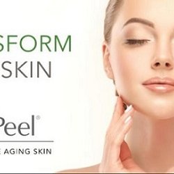 Oxygen Med Spa - Chemical Peel