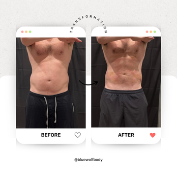 Blue Wolf Transformations - Body Contouring Near Me - Appleton, Wisconsin Blue Wolf Transformations - Body Contouring Near Me - Appleton, Wisconsin