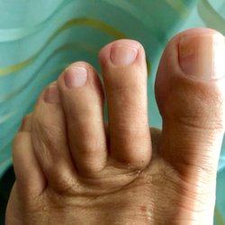 Niagara Central Nail and Spa - My Pedicure with a simple Top Coat (Minus the 'sock fuzz')