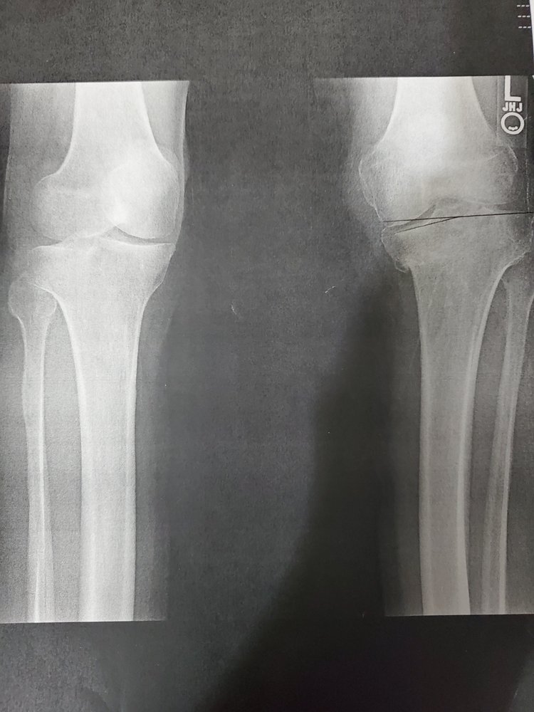 SOUTHERN OREGON ORTHOPEDICS & PARAGON ORTHOPEDIC CENTER Updated