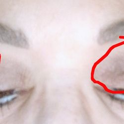 CG Cosmetic Surgery - Skin still hanging after an upper bleph. No answers, call back or email returned.