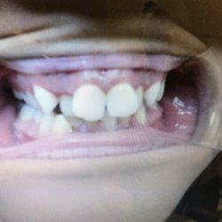 Dorsey Dental Services - Before