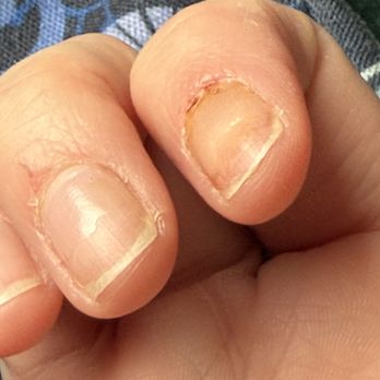 NeO Nail Spa - Damaged skin from the manicure. The polish didn't stay on for 24 hours. - Nail Salons Near Me - Asheville, North Carolina NeO Nail Spa - Damaged skin from the manicure. The polish didn't stay on for 24 hours. - Nail Salons Near Me - Asheville, North Carolina