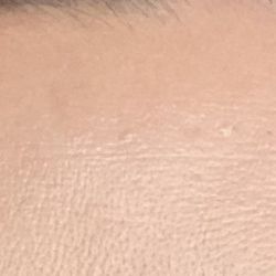 Natasha Good Aesthetician - Before...