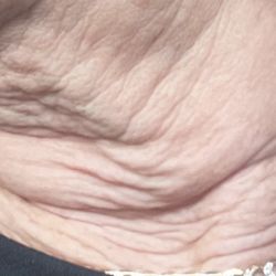 Plastic Surgery Innovations