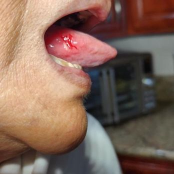 626 Dental Care - My mother was in pain for several days after her visit. She could not eat or drink fluids. - General Dentistry Near Me - El Monte, California