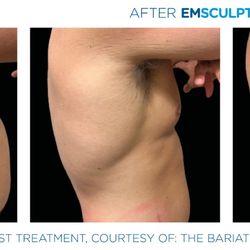 Beauty Drip Medspa - See what we can do with just 30minutes