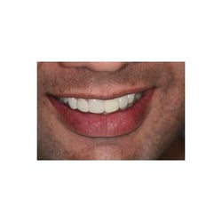 Hornsby Dentist