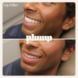 Plump Cosmetics & Injectables