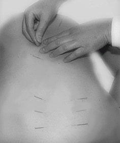 Wellshire Massage & Acupuncture -  Cherry Tower