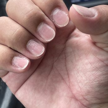 Spa Pointe - Removal of gel and "cleaned up" nails - Skin Care Near Me - Glastonbury, Connecticut