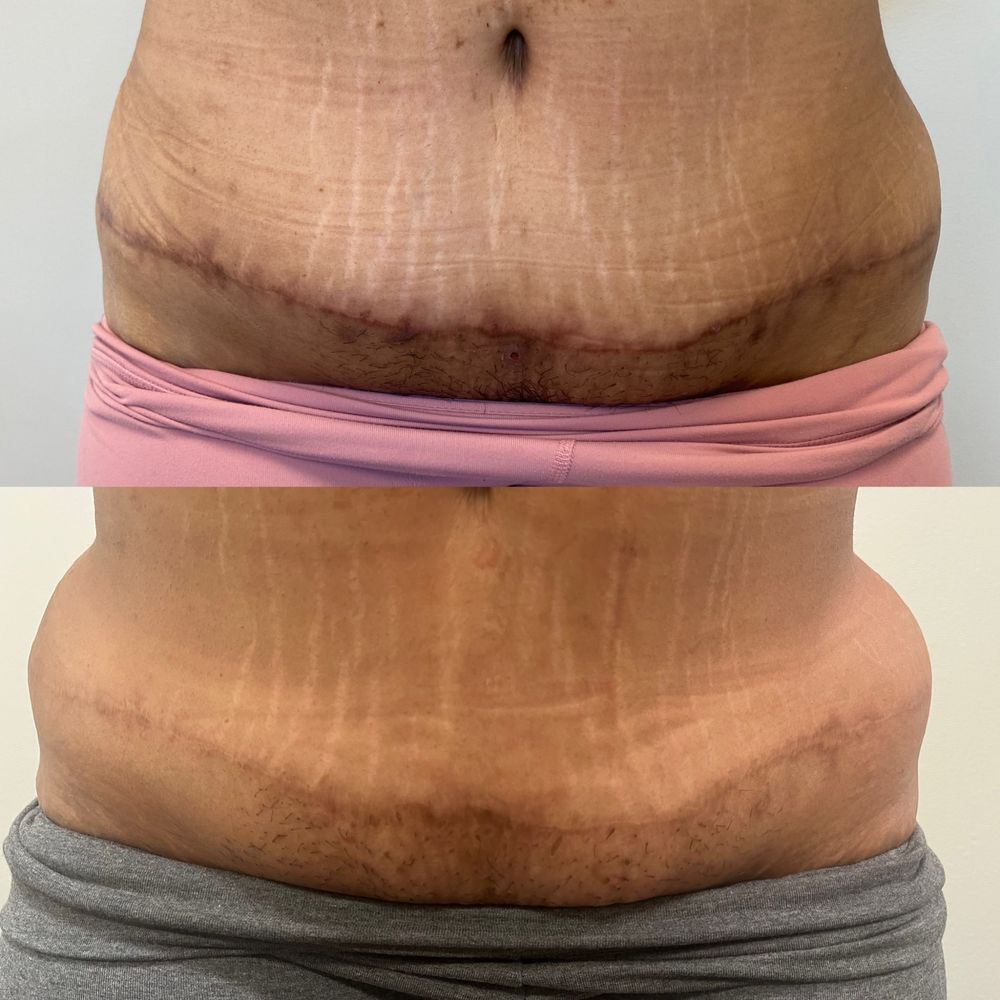 Obsessed Esthetics Logo