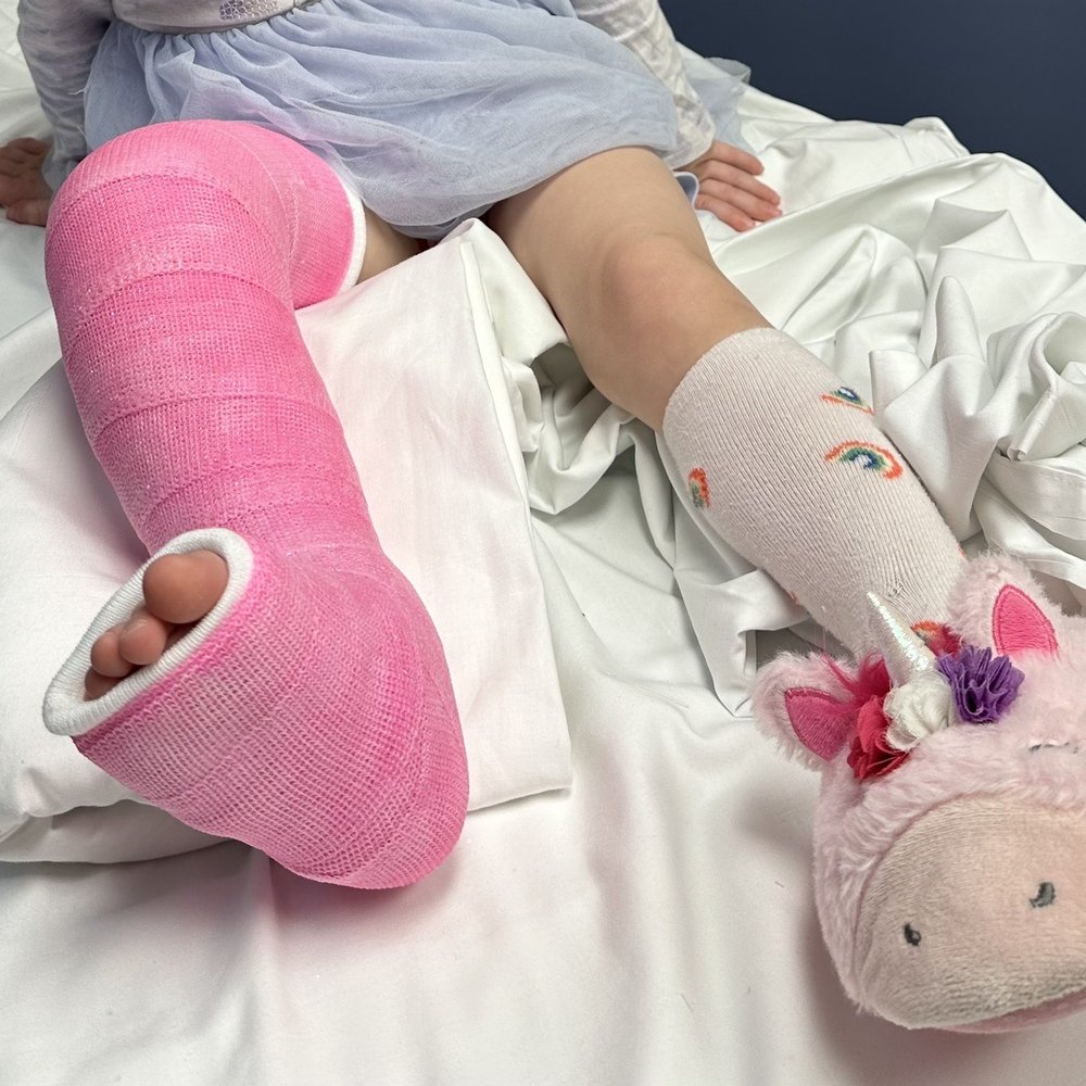 Broken leg Broken leg