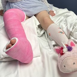 Broken leg Broken leg