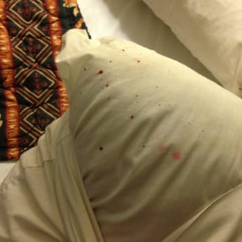 The Blood Stained Pillow Found On The Bed Bug Infested Bed Yelp