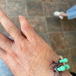 GoOrthopedic - After removing cast