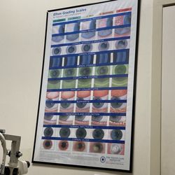 Efron Grading Scales for Contact Lens Complications