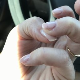 That red line on my ring finger is blood, from where they tore my nail