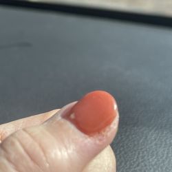 NB Quarry Nails - Bleeding after they cut me.