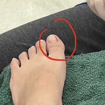 Pearl Nails - After she cleaned it, still little red - Nail Salons Near Me - Rosemead, California Pearl Nails - After she cleaned it, still little red - Nail Salons Near Me - Rosemead, California