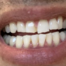 Gentle Care Dental - Before the work