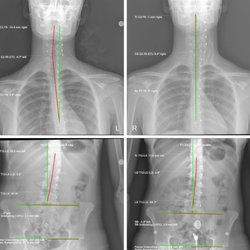 Structural Chiropractic