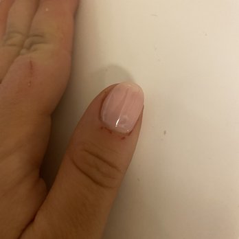 Dream Nails - Bleeding cuticles - Nail Salons Near Me - Los Angeles, California