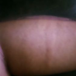El Noel Eco-Center for Integrative Wellness - Left arm breakout.