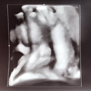 Baby Bump Studios - Diagnostic Imaging Near Me - Ontario, California Baby Bump Studios - Diagnostic Imaging Near Me - Ontario, California