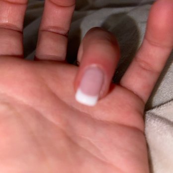 Pristine Nail & DaySpa - Painful cut, swollen, burns every time I wash - Nail Salons Near Me - Winter Park, Florida