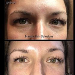 Etanda Skin Solutions