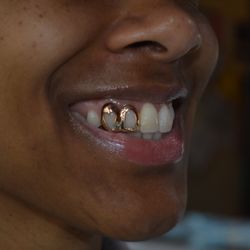 Baltimore Gold Fronts - Customer.