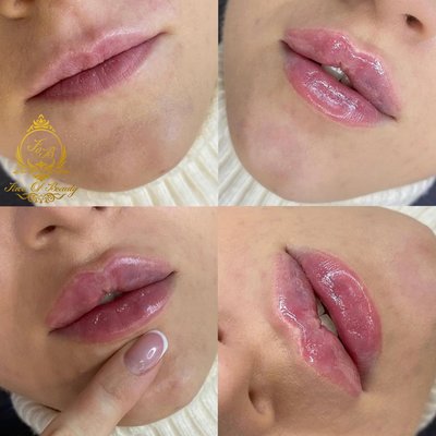 Face Of Beauty by null