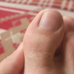 Gouges on nail from technician