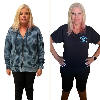 Transform Your Body with Semaglutide Weight Loss Treatments - Our dedicated team is here to guide you through every step of your transformation with Semaglutide, a revolutionary treatment proven to aid in significant weight loss. By focusing on more than just medication, we integrate essential diet and nutrition strategies to optimize your results and ensure you achieve—and maintain—your ideal weight. Experience the change you’ve been seeking and the support you deserve at DermaVogue. Transform Your Body with Semaglutide Weight Loss Treatments - Our dedicated team is here to guide you through every step of your transformation with Semaglutide, a revolutionary treatment proven to aid in significant weight loss. By focusing on more than just medication, we integrate essential diet and nutrition strategies to optimize your results and ensure you achieve—and maintain—your ideal weight. Experience the change you’ve been seeking and the support you deserve at DermaVogue.