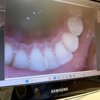Monika Bhatia, DDS - Pre-cleaning - Endodontists Near Me - Hicksville, New York Monika Bhatia, DDS - Pre-cleaning - Endodontists Near Me - Hicksville, New York