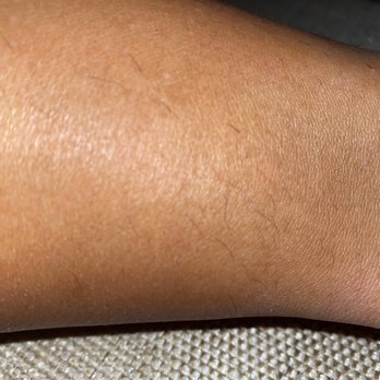 Sugaring NYC - Back of my leg with hair still left on it. - Eyelash Service Near Me - New York, New York Sugaring NYC - Back of my leg with hair still left on it. - Eyelash Service Near Me - New York, New York