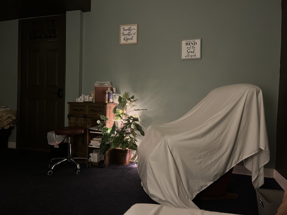 Acupuncture In Grand Junction at Doris Vanburen blog