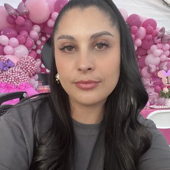 LaserAway - I get Botox in my forehead area, my 11's, and my crows feet. I love the results! - Medical Spas Near Me - Hermosa Beach, California LaserAway - I get Botox in my forehead area, my 11's, and my crows feet. I love the results! - Medical Spas Near Me - Hermosa Beach, California