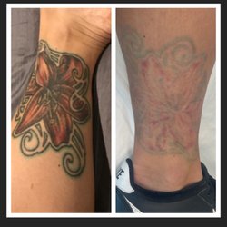 Colorado Skin and Vein