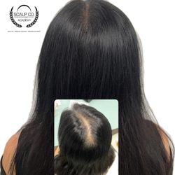 Scalp Co.