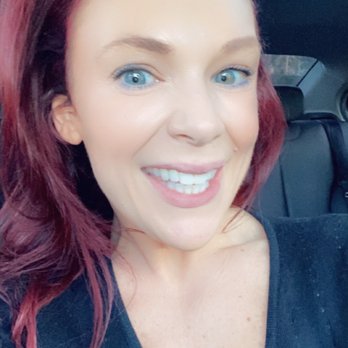 Foothill Ranch Dentistry by Dr.Aria Irvani - Immediately after having my teeth repaired!  My friends & family were absolutely amazed! - General Dentistry Near Me - Foothill Ranch, California