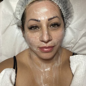 Enlightened Beauty - Numbing lotion, before microneedling - Skin Care Near Me - Torrance, California Enlightened Beauty - Numbing lotion, before microneedling - Skin Care Near Me - Torrance, California