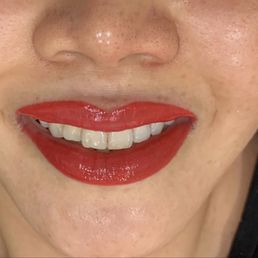 Right after lip tattooing Right after lip tattooing