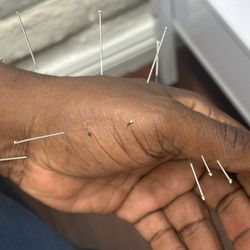 Healing Acupuncture and Oriental Medicine Clinic